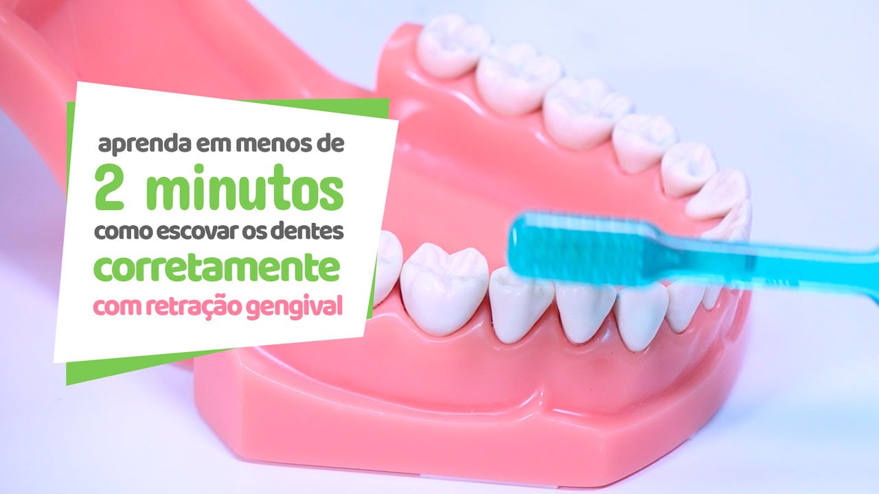 Como escovar os dentes com retração gengival - Cir Hospital Odontológico
