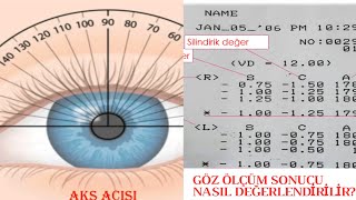 Gozluk Recete Bilgisi Goz Olcum Sonucu Incelemesi Youtube