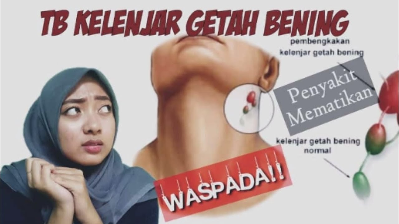 Apakah tb kelenjar menular