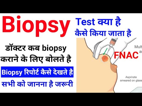 वीडियो: MATLAB का उपयोग करके वयस्क श्रवण परीक्षण कैसे करें: 6 चरण वीडियो: MATLAB का उपयोग करके वयस्क श्रवण परीक्षण कैसे करें: 6 चरण