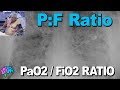 Pao2 to fio2 ratio  pf ratio