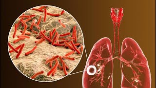 محاضرة بكتيريا السل (الجزء الاول)   Lecture: Mycobacteria (Part I)