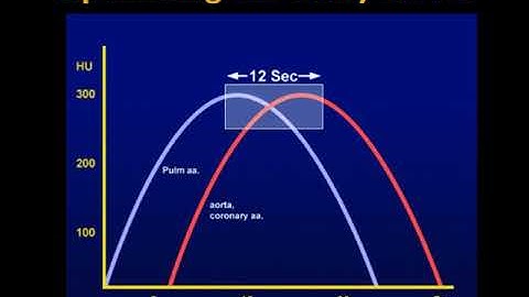 Evaluation of Chest Pain: the Triple Rule Out Part 2