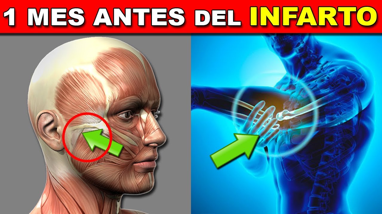 SEÑALES 1 MES ANTES DEL INFARTO | SIGNOS DE UN ATAQUE AL CORAZÓN - YouTube