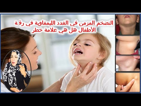 فيديو: كيفية اختيار وصيانة الحوض الساخن