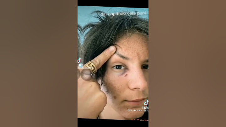 ecco cosa è  successo a cap ieri  riprenditi capitano