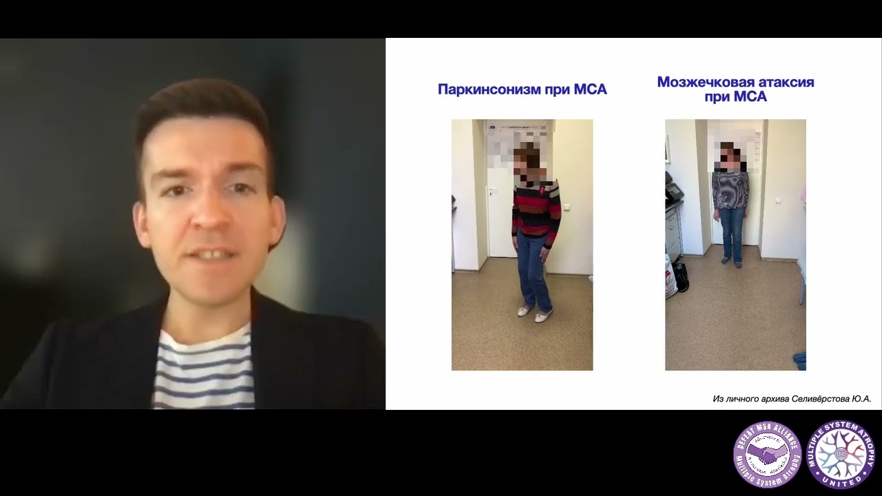 Что нового в диагностике мультисистемной атрофии? - Юрий Селиверстов, MD, PhD