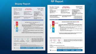 Decipher Test Report Overview