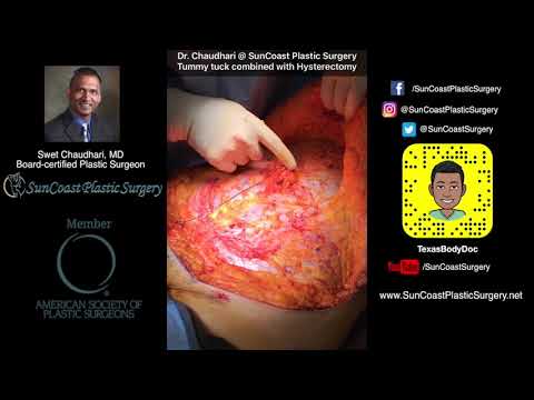 Tummy tuck combined with Hysterectomy