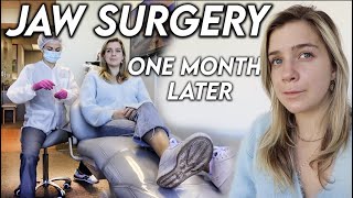 Jaw Surgery One Month Later: Getting screws out & swelling is going down!