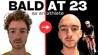 A Complete Guide To Going Bald As A Cyclist