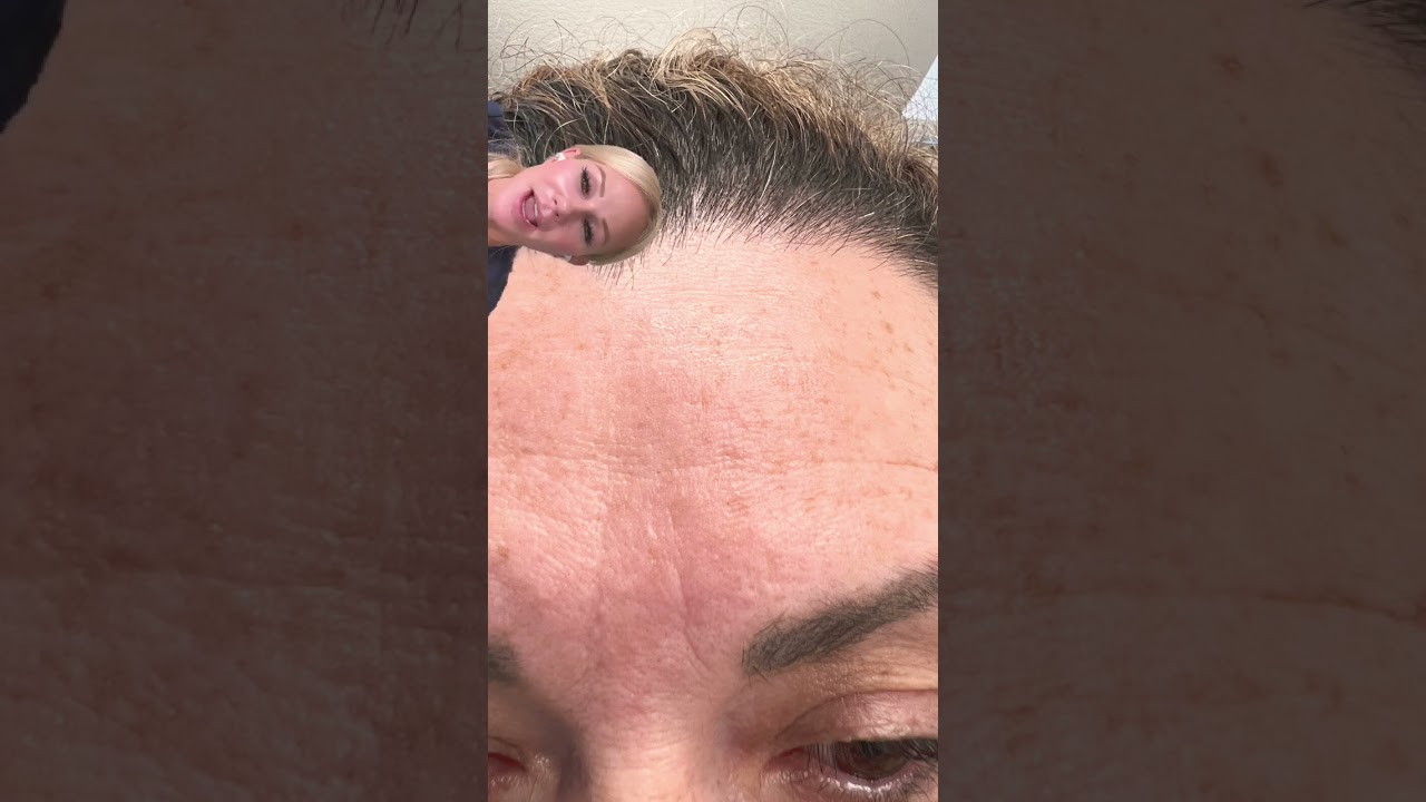 How to ERASE stubborn ELEVEN LINES 