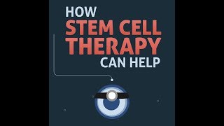 What Diseases Can Be Treated with Stem Cell Therapy | Bioinformant