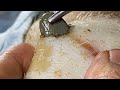 ASMR😪間の睡眠導入 スクラッチで深い眠りへ Professional Pedicure DR LEE’S ULTIMATE ZITPOPPER 3010M40769