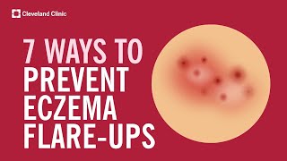 7 Ways to Prevent Eczema Flare-Ups