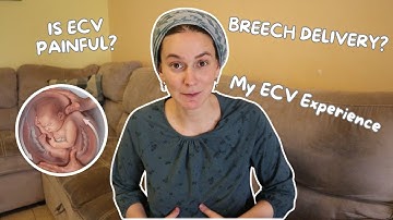 Breech Baby Weeks 36 - 38  | ECV Success Tips & Natural Turning Methods