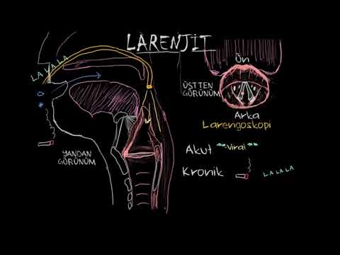 Larenjit Tanısı, Tedavisi ve Önlenmesi (Fen Bilimleri)(Sağlık ve Tıp)