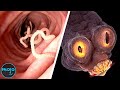 Top 10 Grossest Parasites (And What They Do To Your Body)