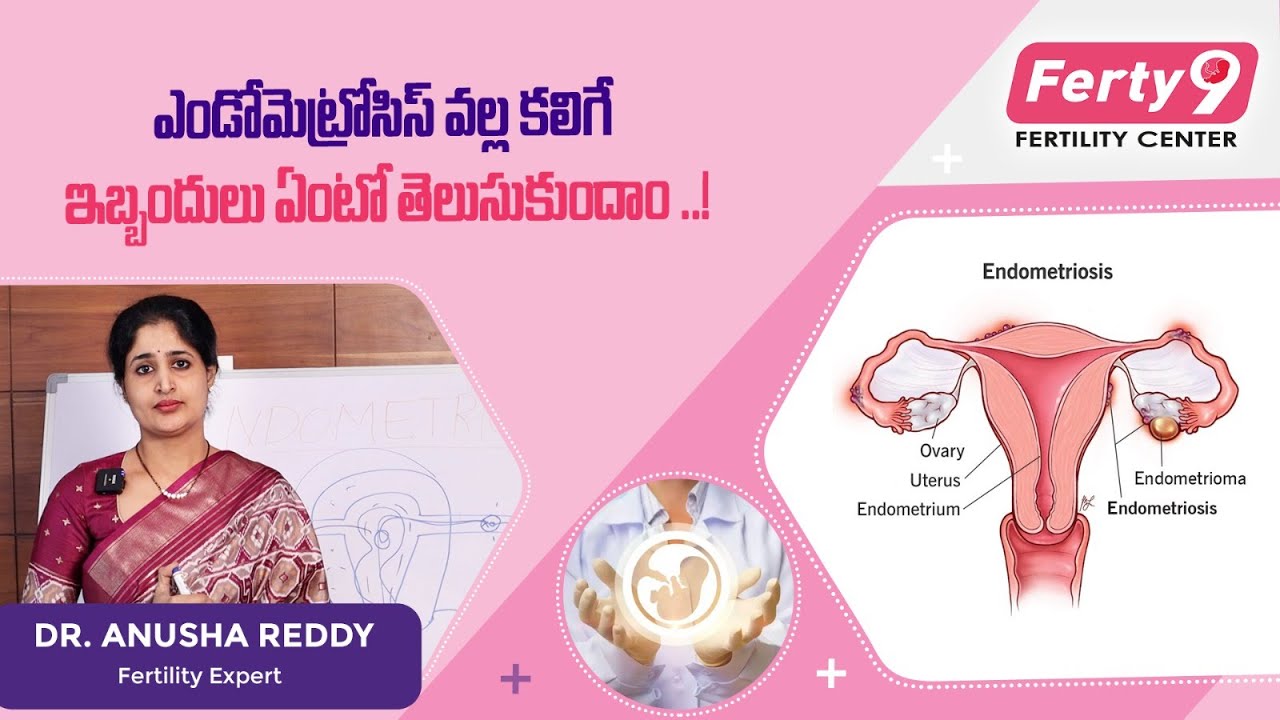 Endometriosis symptoms, causes, and treatments in Telugu | #endometriosis