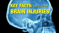 Personal Injury: Important facts about traumatic brain injury because of a car accident