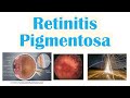 Retinitis Pigmentosa | Genetics, Pathophysiology, Signs & Symptoms, Diagnosis, Treatment