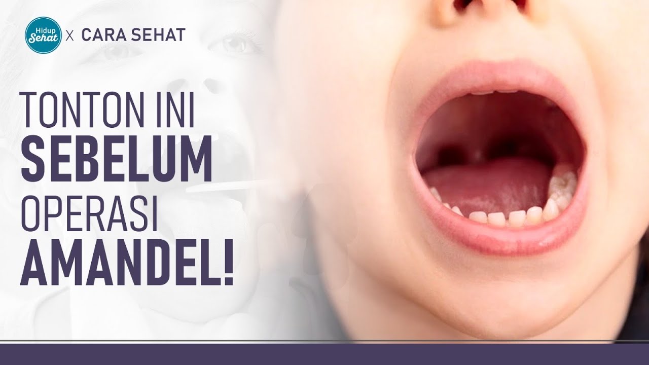 Semua Yang Harus Diketahui Sebelum Operasi Amandel | Hidup Sehat tvOne