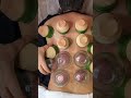 Cupping #relax #painrehabb #massagetherapy #cupping #cupping #acupuncture #trending #cricket #gym