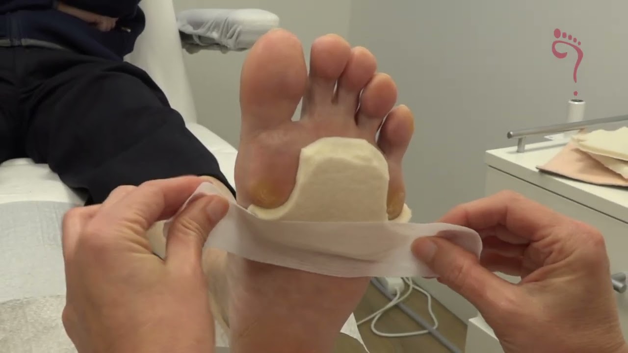 Pedicure van Dalen | Drukvrij met Vilt