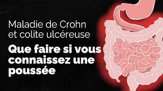 Que faire si vous connaissez une poussée de la MII? | Société gastro-intestinale