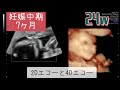 妊娠24週のエコー動画　2D・4Dエコー見比べ