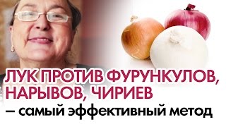 ЛУК ОТ ФУРУНКУЛОВ И ЧИРИЕВ. Народный способ