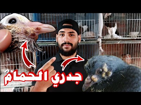 فيديو: القضاء على الجدري