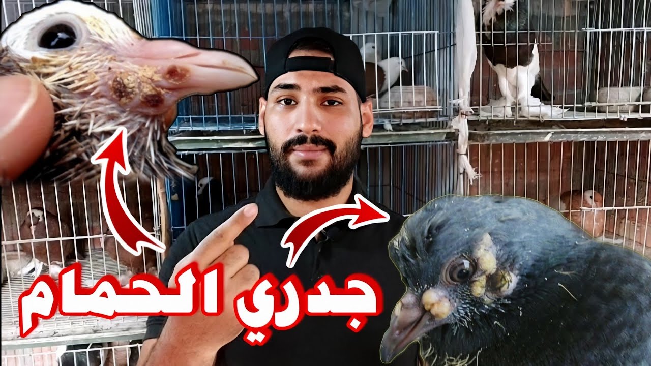 مش هاتشوف مرض الجدري في الحمام | الوقايه بالتفصيل