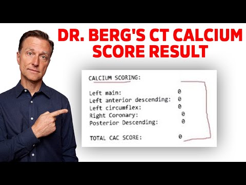 dr.-berg-gets-his-ct-calcium-scoring-test-results