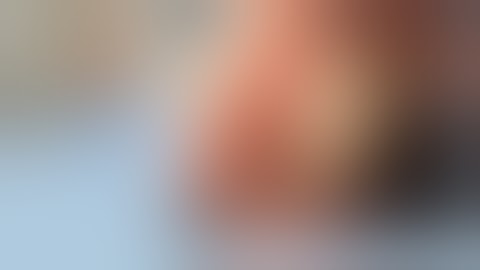 Full thickness resection small GIST in stomach