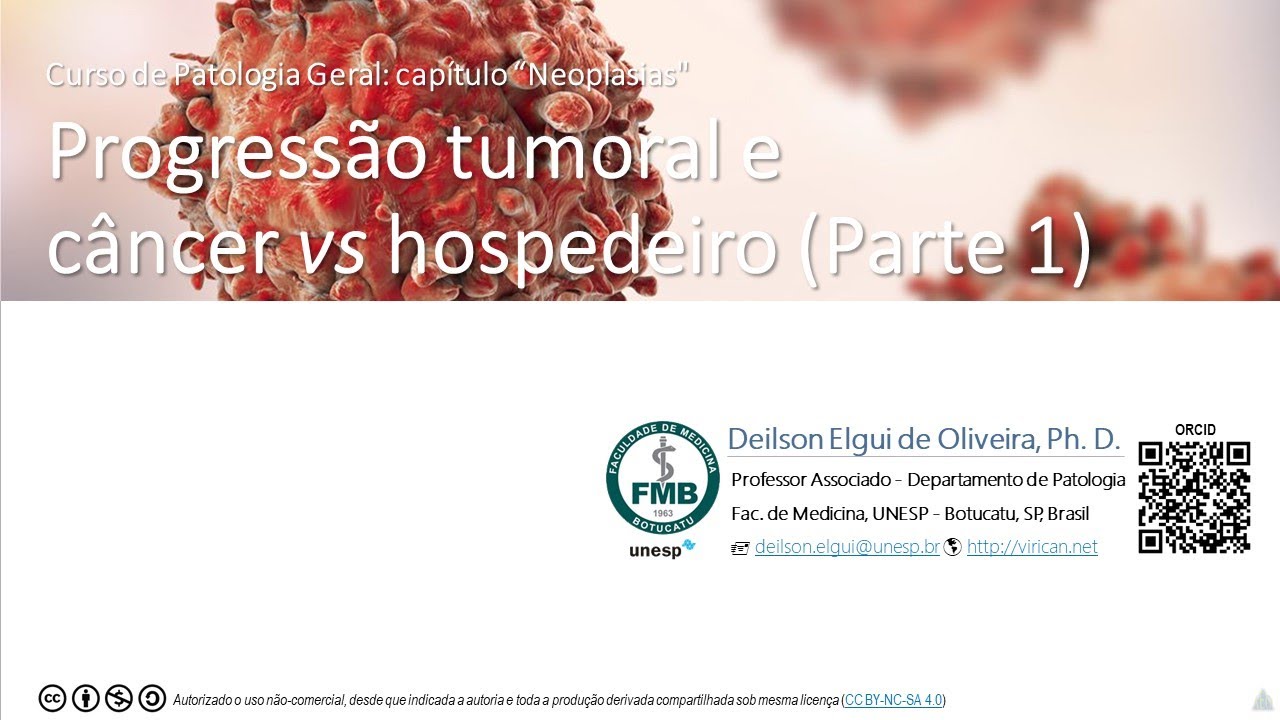 Progressão tumoral e câncer vs hospedeiro, Parte 1 (Patologia Geral, capítulo "Neoplasias")