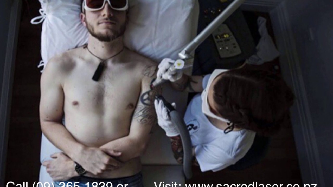 Does Laser Tattoo Removal Hurt with Laser Tattoo Removal Machine Call