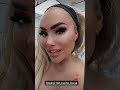 90 Day Fiance: Darcey Gets More Cosmetic Work! ##90dayfiance