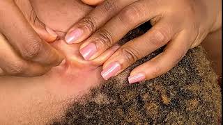 ASMR SATISFYING EAR CLEANING| WELL ZOOMED