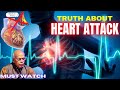 Heart blocks are not the cause of heart attack  dr b m hegde
