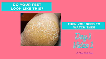 Can you use drops of youth on your feet?