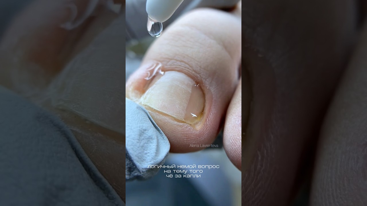 Чудо-капли 💧 158510615 