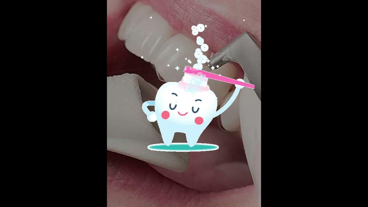 How to remove black stains on teeth? YouTube