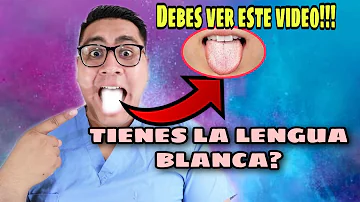 ¿Tu lengua se vuelve blanca cuando no te cepillas los dientes?