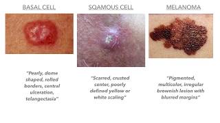 Dermatology on USMLE/COMLEX