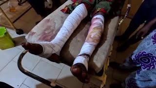 Pain and horror follow massacre in Nigerian Catholic church