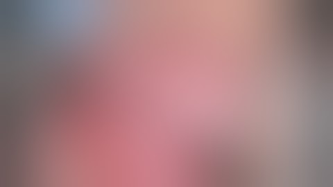 Trigeminal interfascicular neurolysis (nerve combing) forrefractory recurrent neuralgia in MS