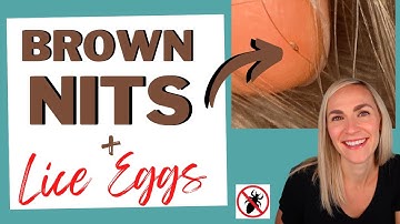 Brown Nits and Lice Eggs: What it Means
