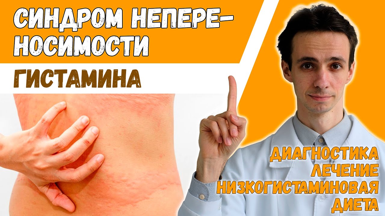 Гистаминоз