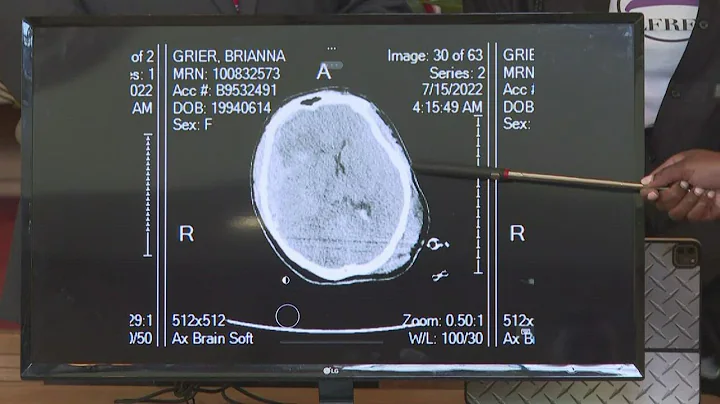 Pathologist presents independent results from Bria...